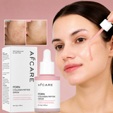 Korean Salmon PDRN Collagen Acne Repair Serum