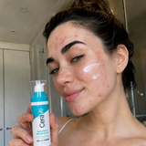 CeraVe Retinol Serum for Acne Prone Skin – Niacinamide, Licorice Root & Barrier Repair