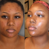 Vitamin C Body & Face Lotion – Brightening Moisturizer for Dark Spots, Fine Lines & Uneven Skin Tone